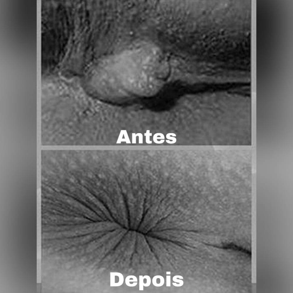 Pomada Chinesa Original Dictamni [PAGUE 2 E LEVE 3]